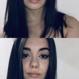 nahiasis